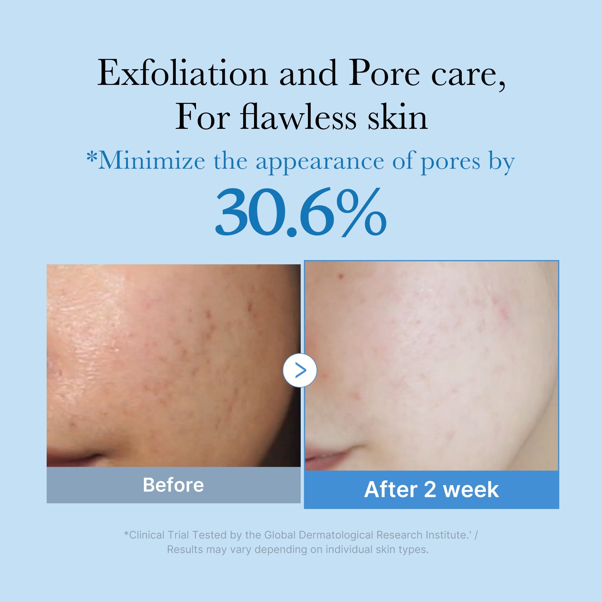 Zero Pore Toner Y0