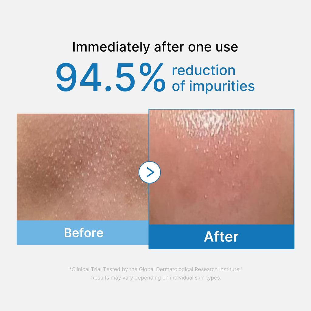 Zero Pore Blackhead Deep Cleansing Oil M9