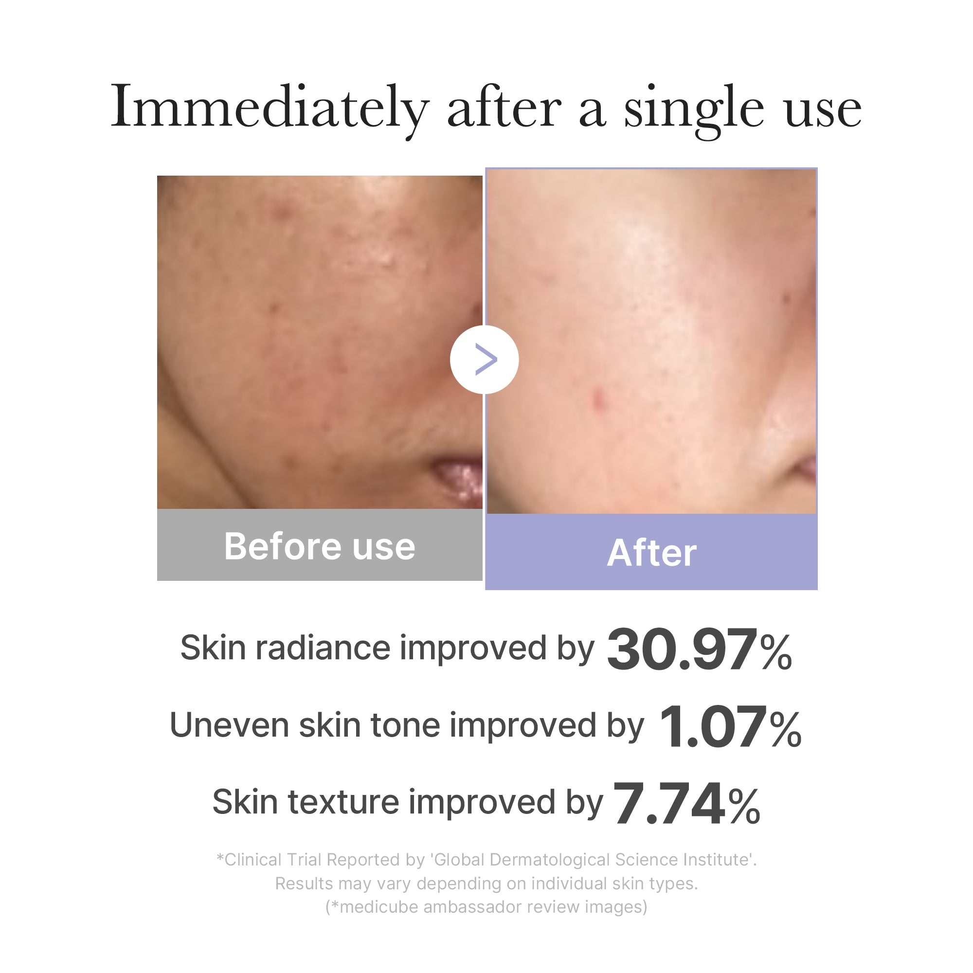 [CS] Mini Booster Pro Z2