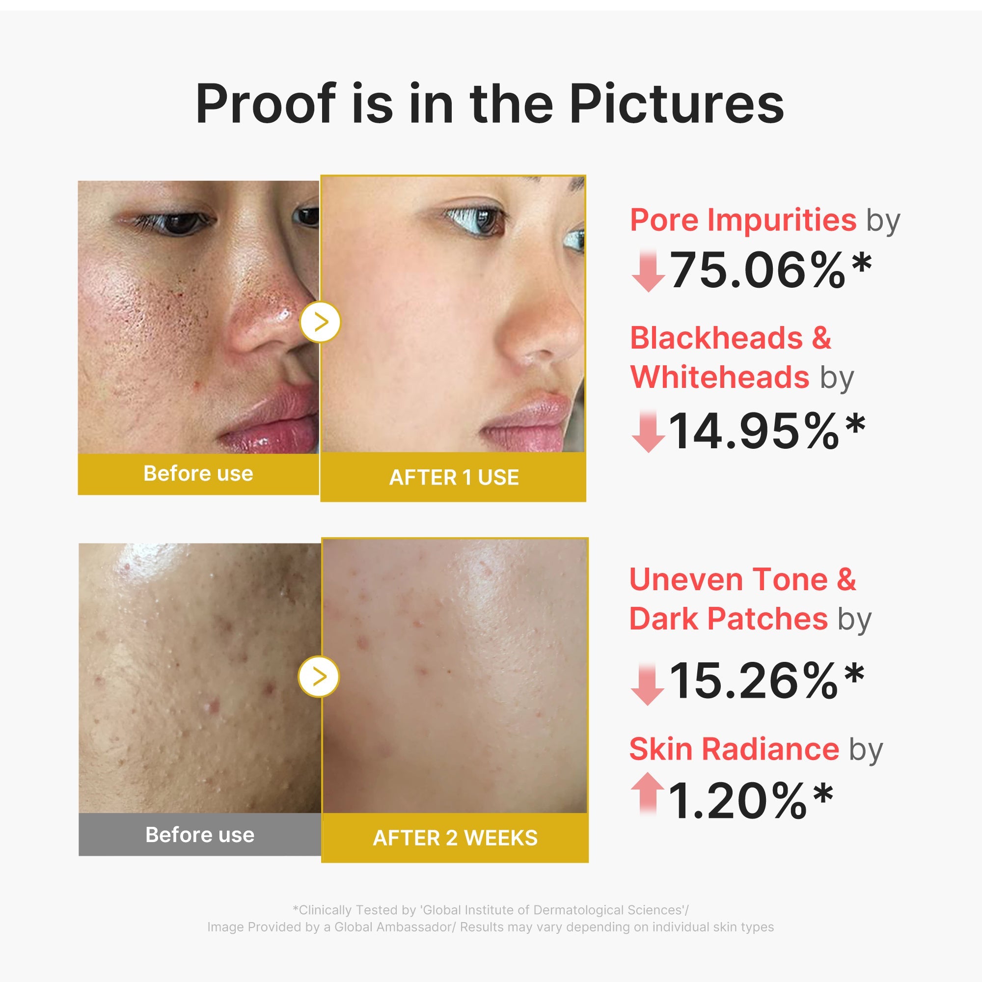 Kojic Acid Turmeric Peel Shot F9