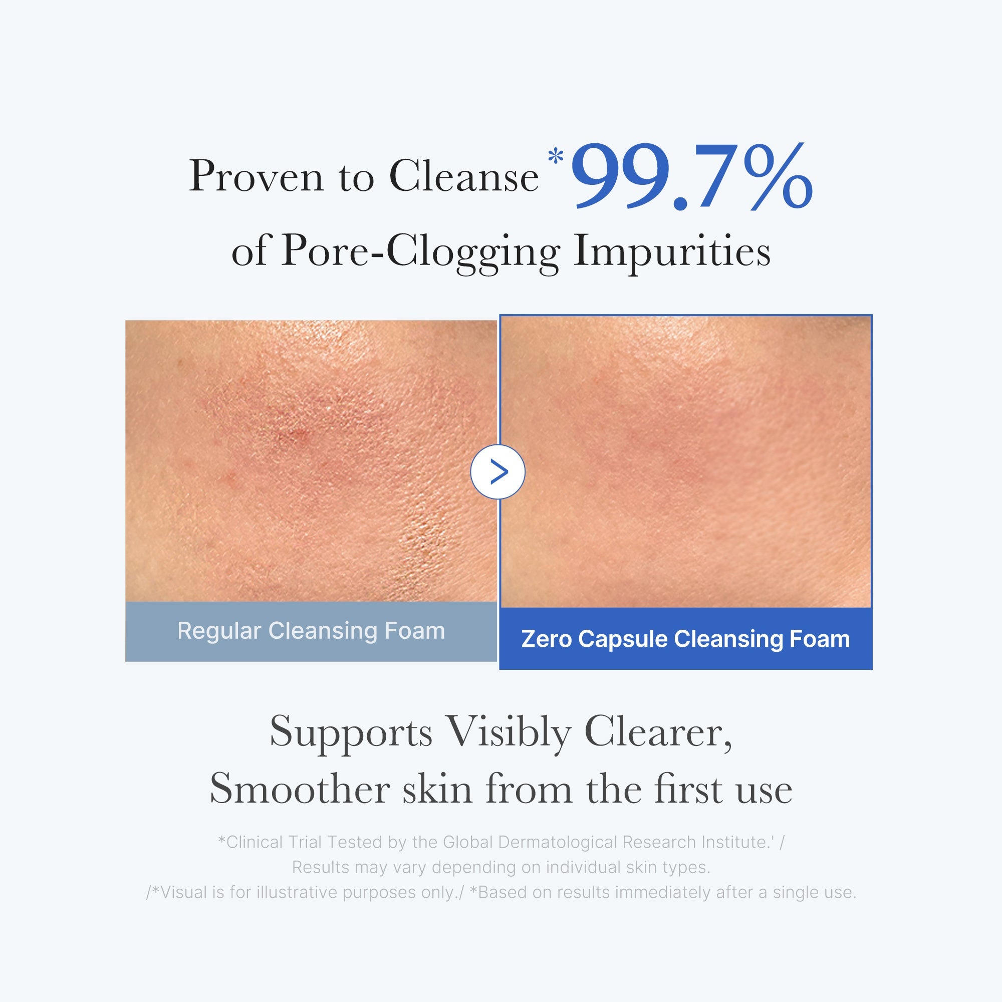 Zero Pore Capsule Cleansing Foam F8