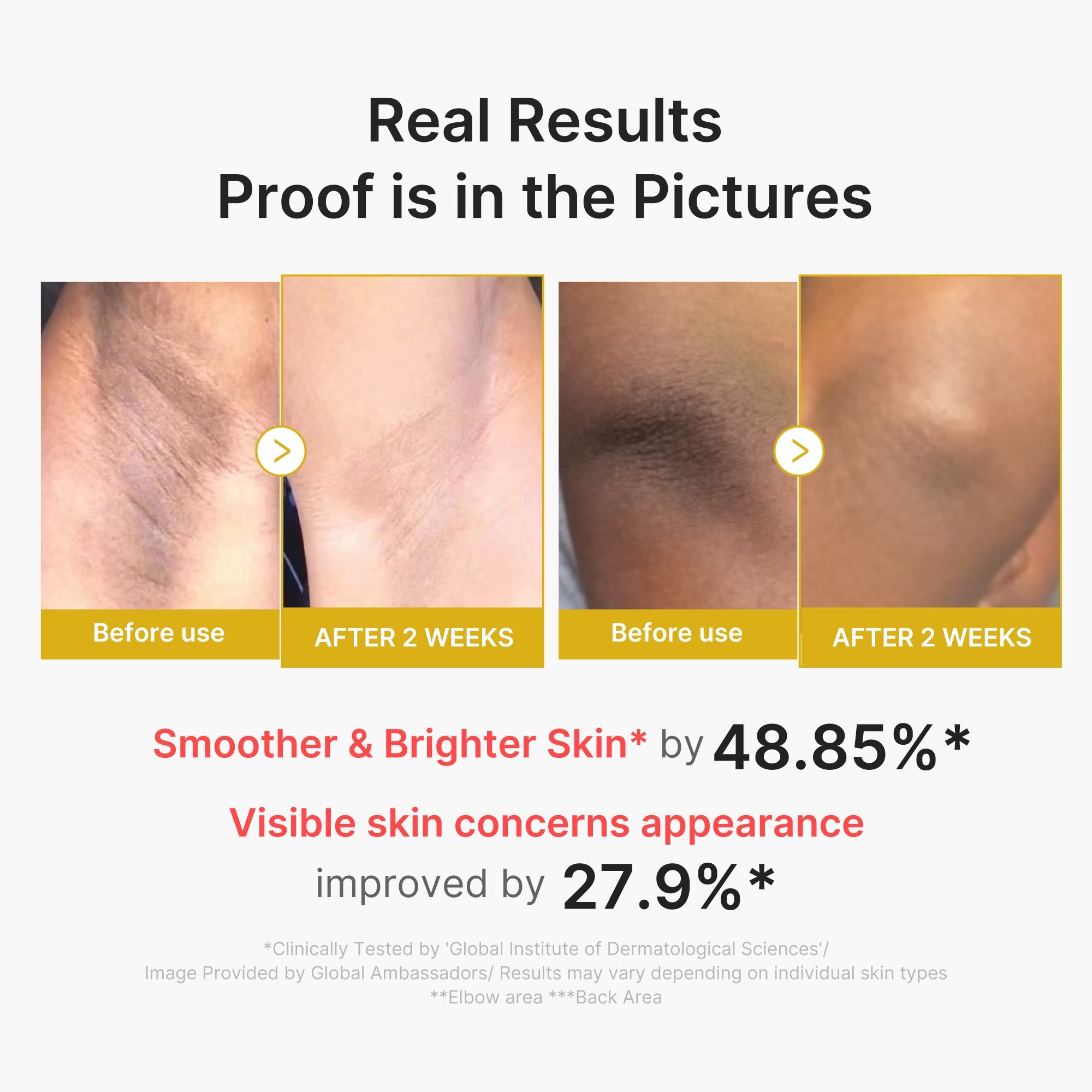 Kojic Acid Turmeric Body Peel Shot J0