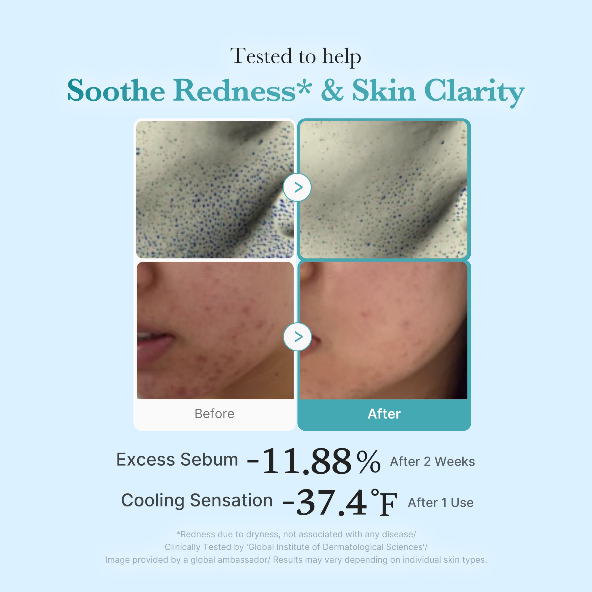Azelaic Acid Niacinamide Clarifying Toner V0