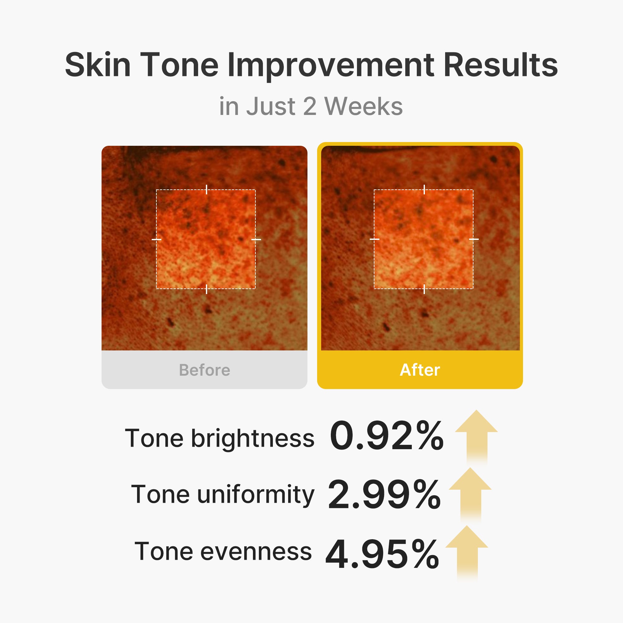 Kojic Acid Turmeric Vita Capsule Cream X9