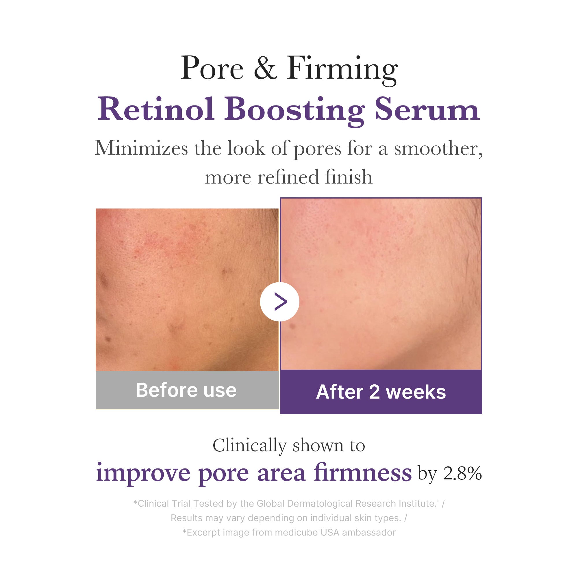 Retinol NMN Boosting Serum A7