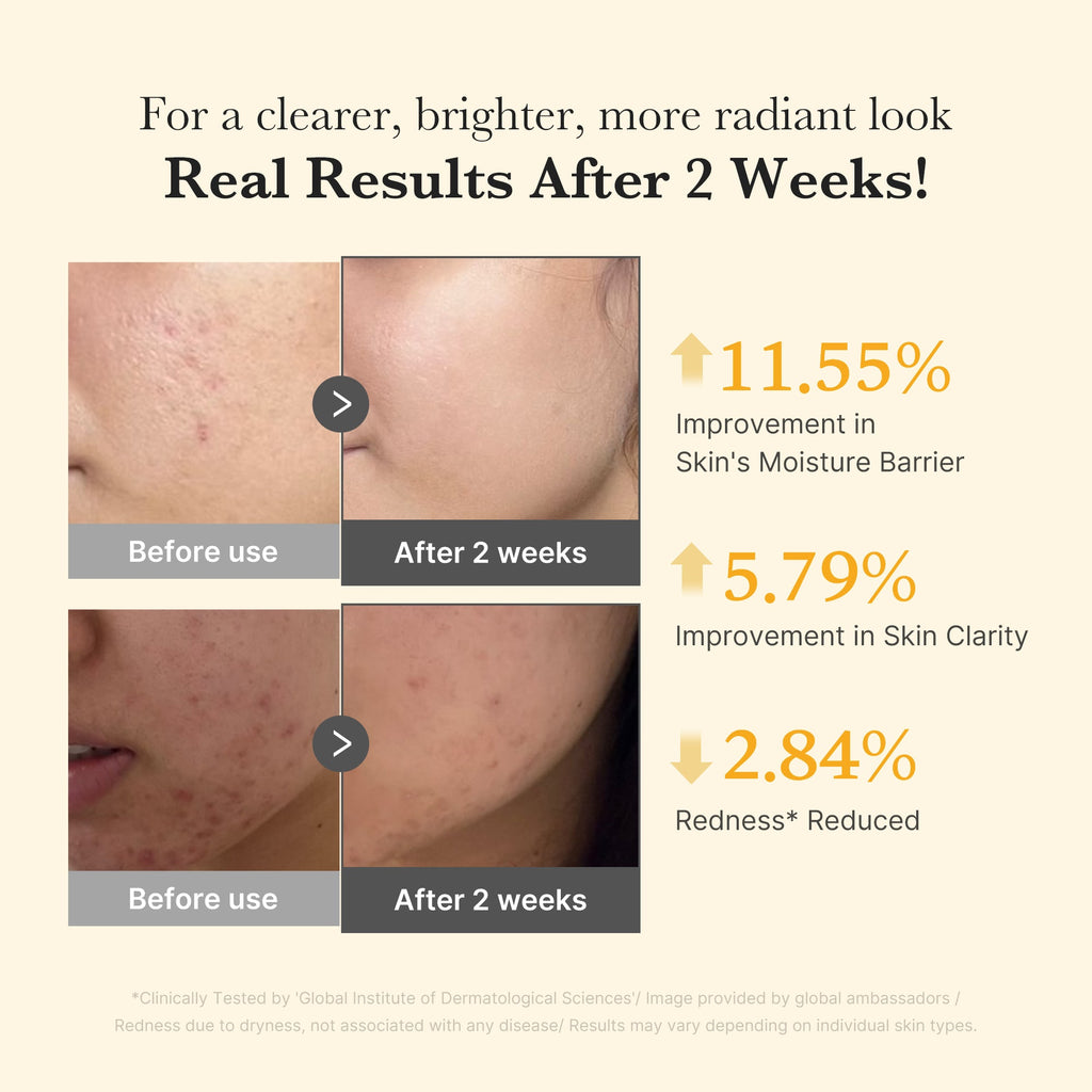 Kojic Acid Turmeric Capsule Serum I2