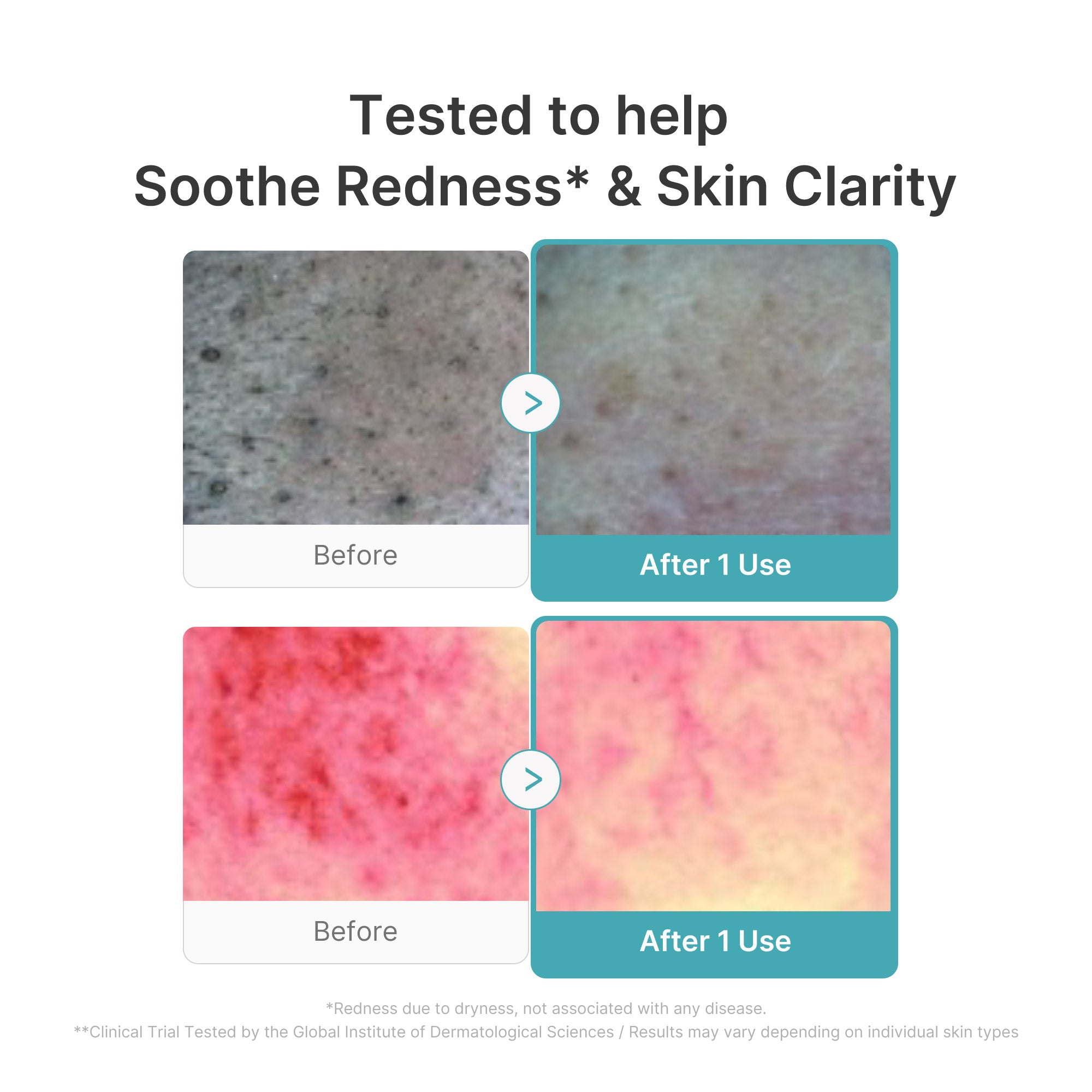 Azelaic Acid Capsule Foam Cleanser N8