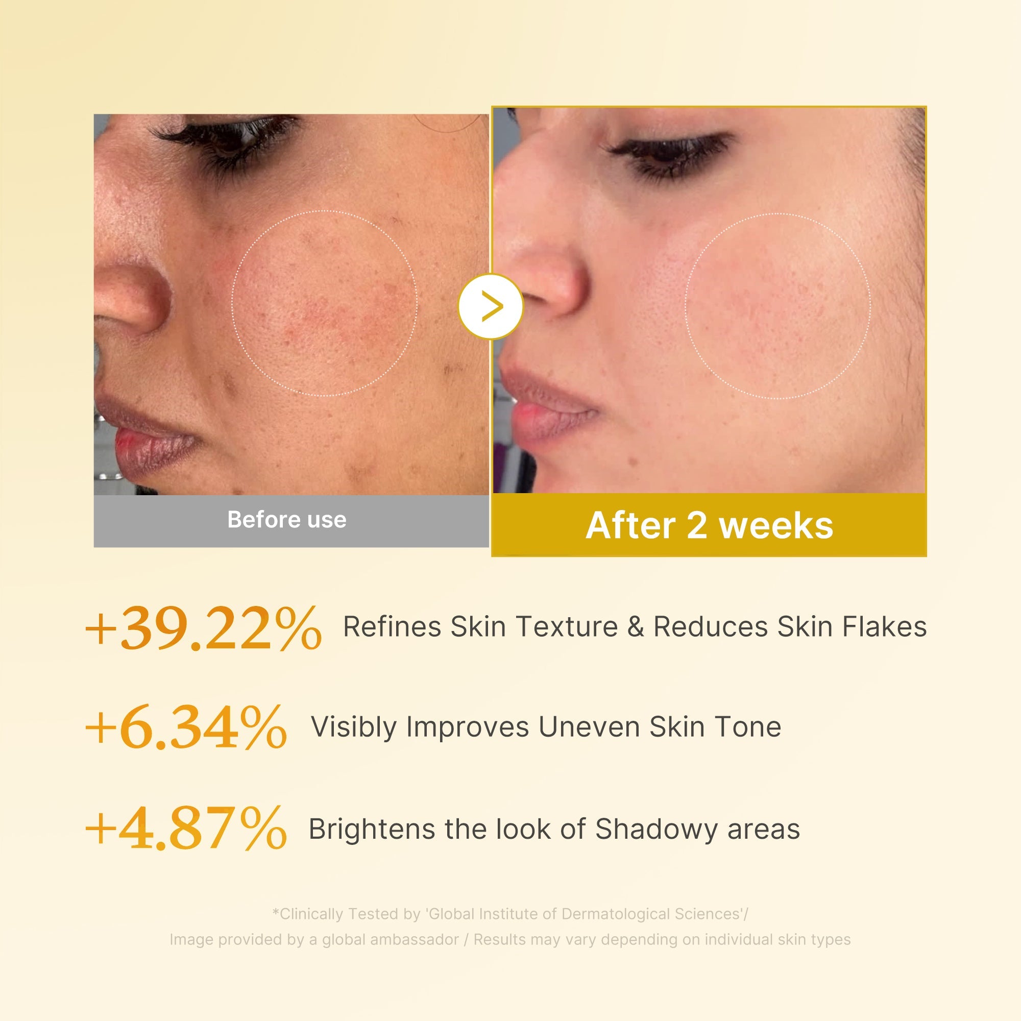 Kojic Acid Turmeric Toner I2