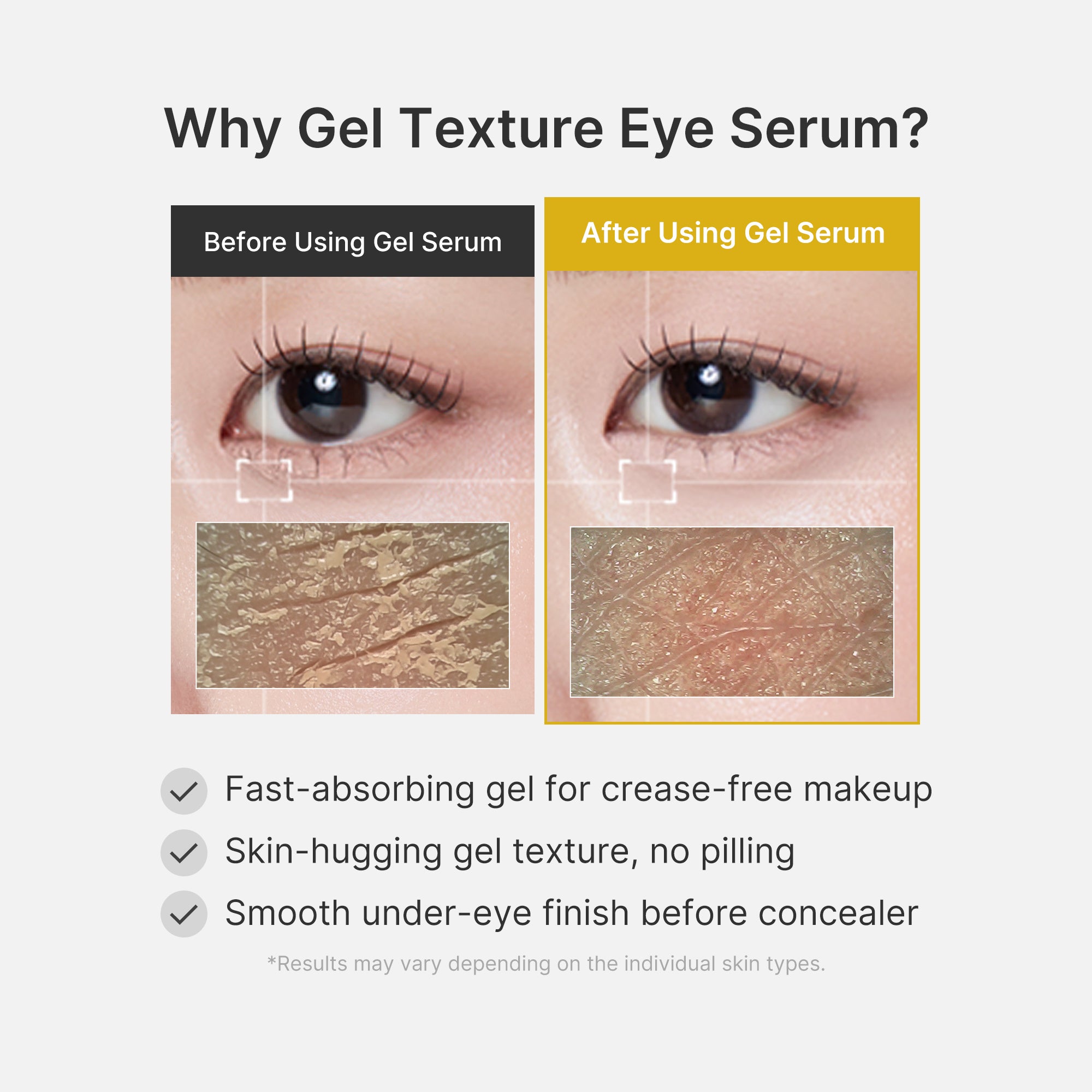 Kojic Acid Tumeric Eye Gel Serum X3