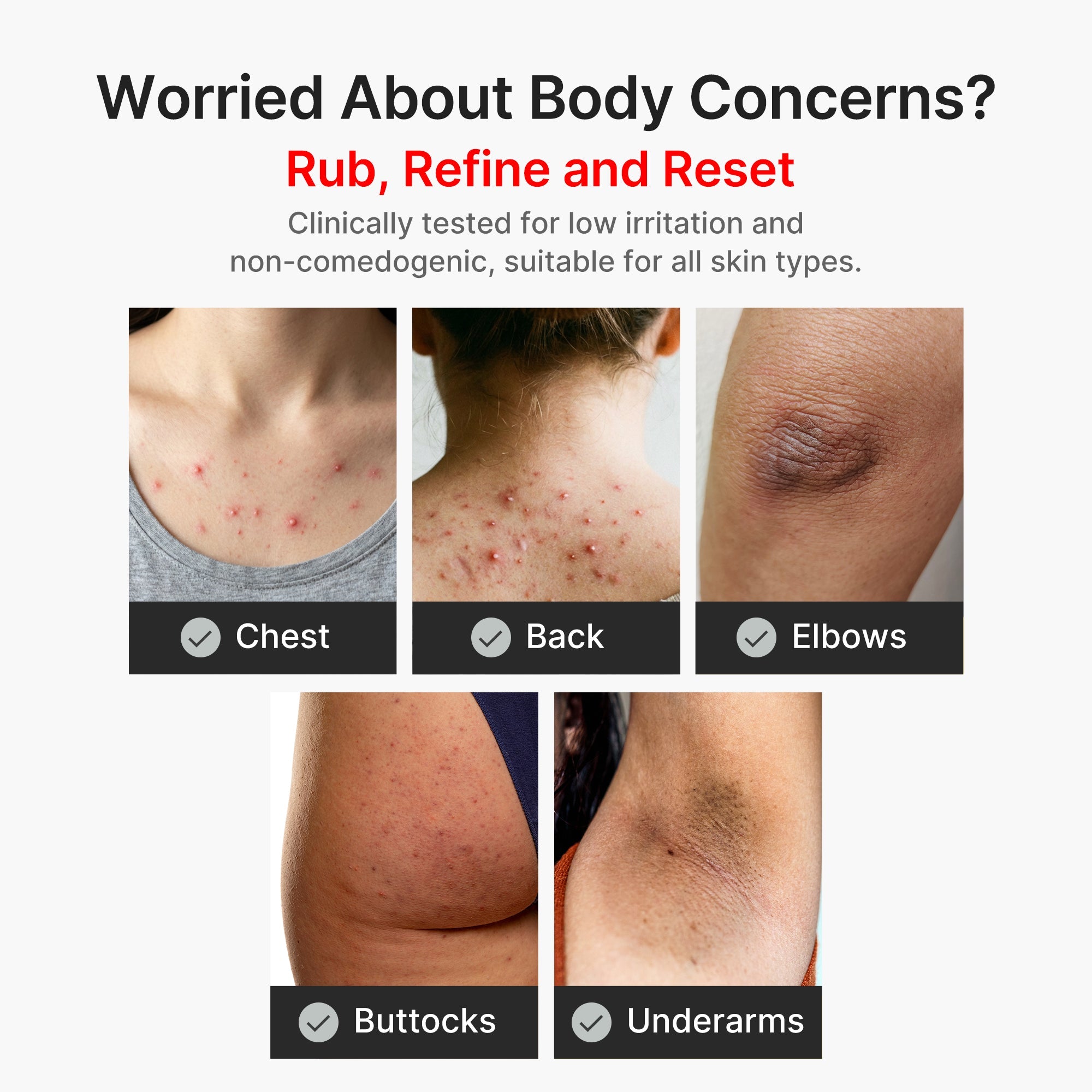 Kojic Acid Turmeric Body Peel Shot J0