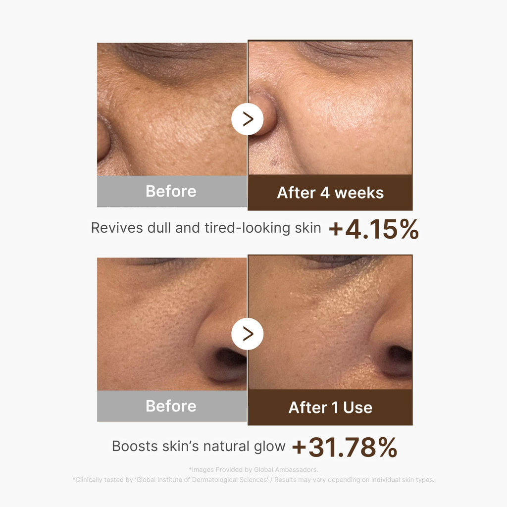 Deep Vitamin C Capsule Serum I0