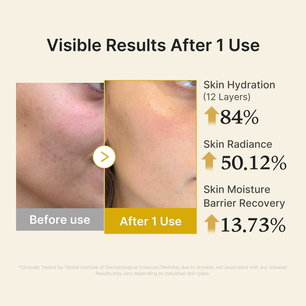Kojic Acid Turmeric Vitamin Gold Jelly Mist Serum M4