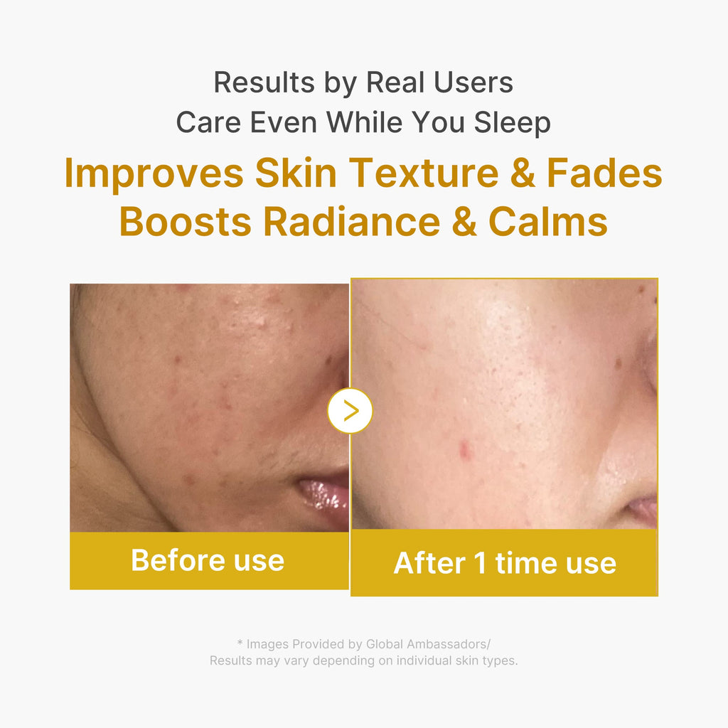 Kojic Acid Turmeric Overnight Wrapping Mask R3