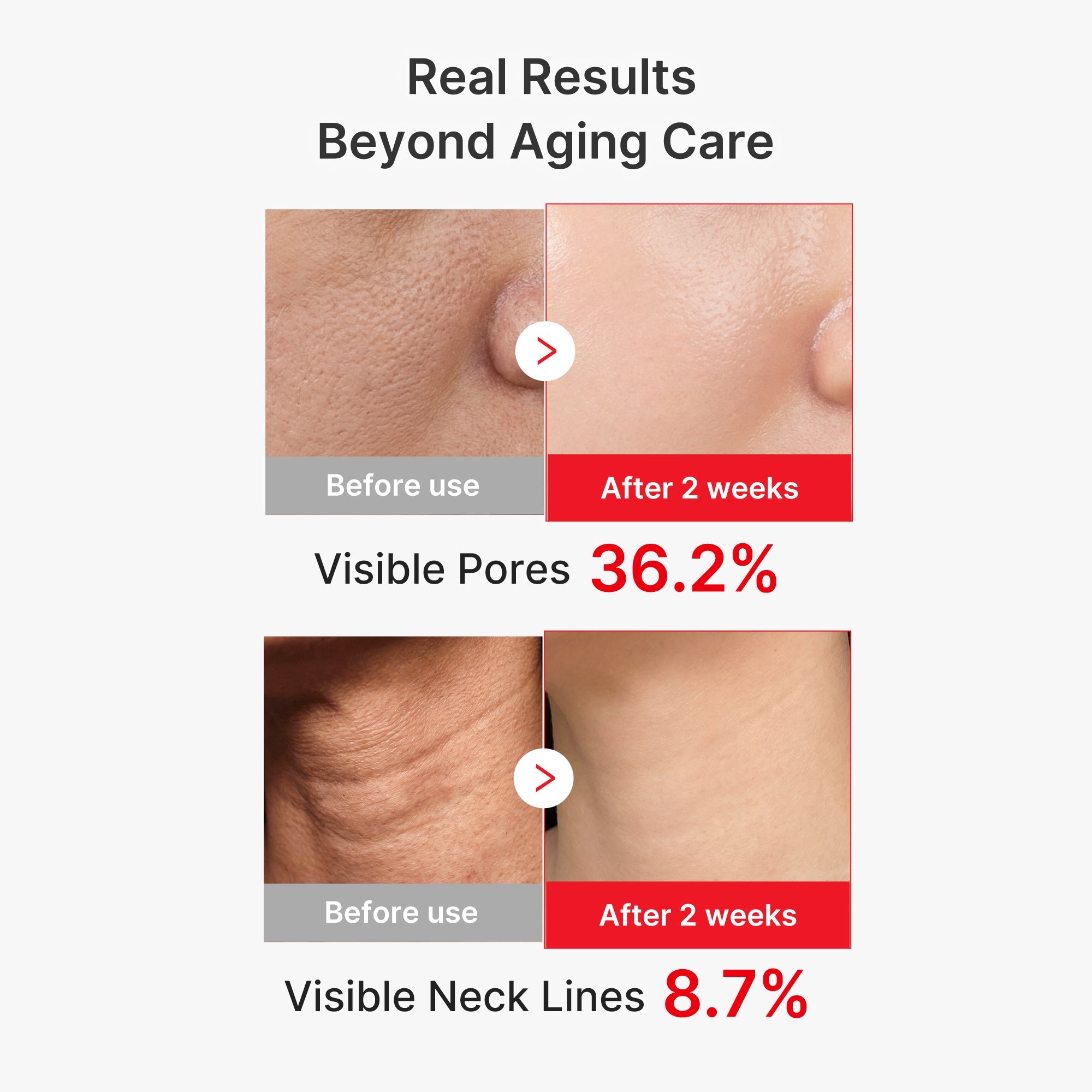 EGF NAD+ Firming Serum Q4