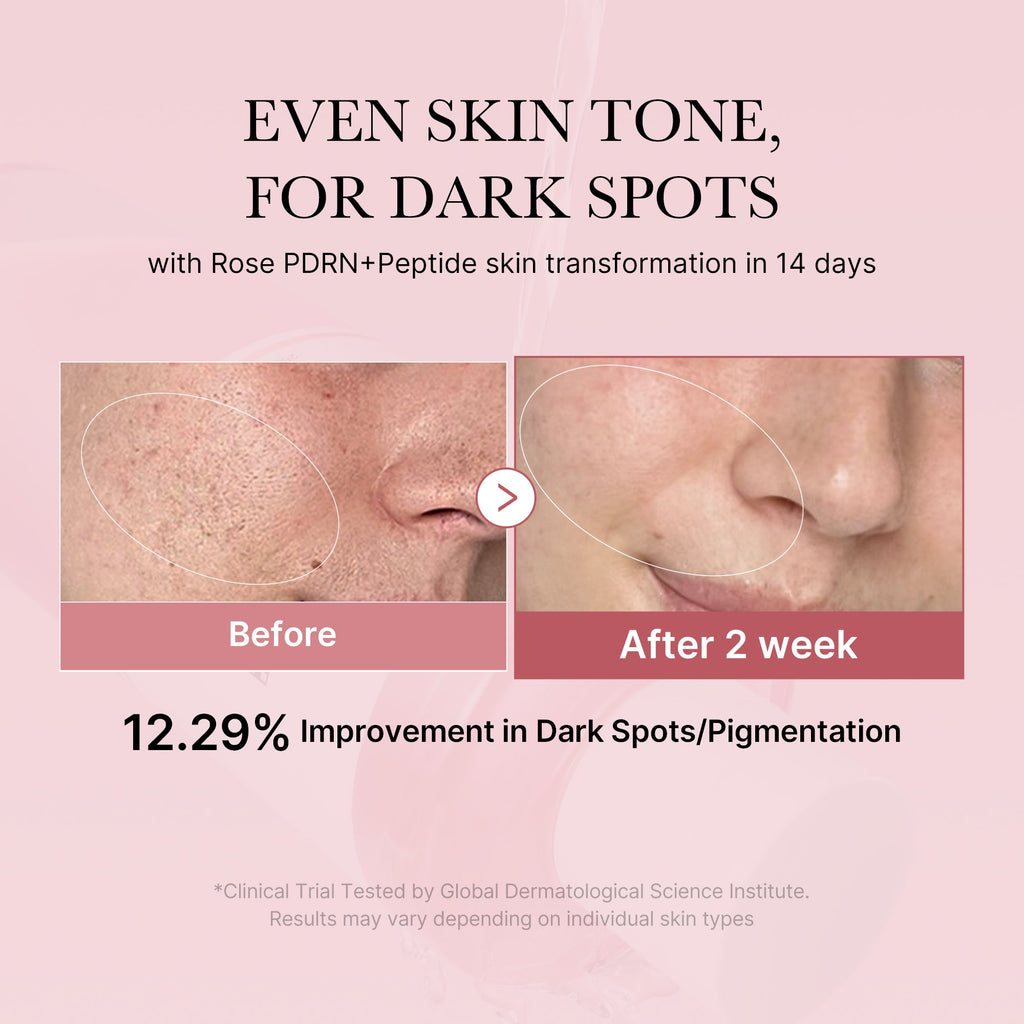 PDRN Pink Peptide Toner Q5