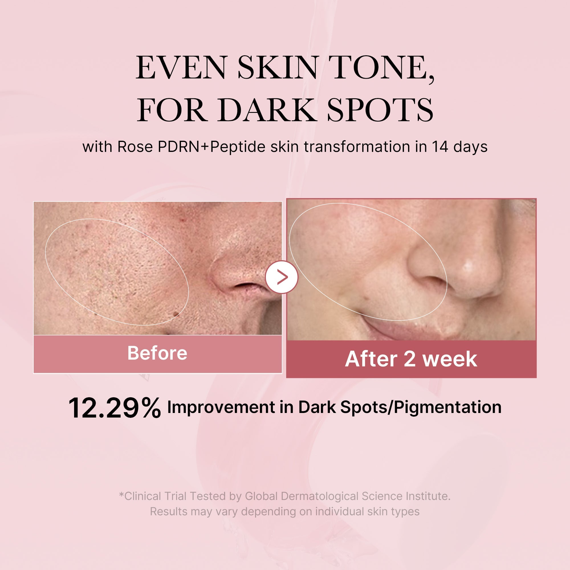 PDRN Pink Peptide Toner Q5