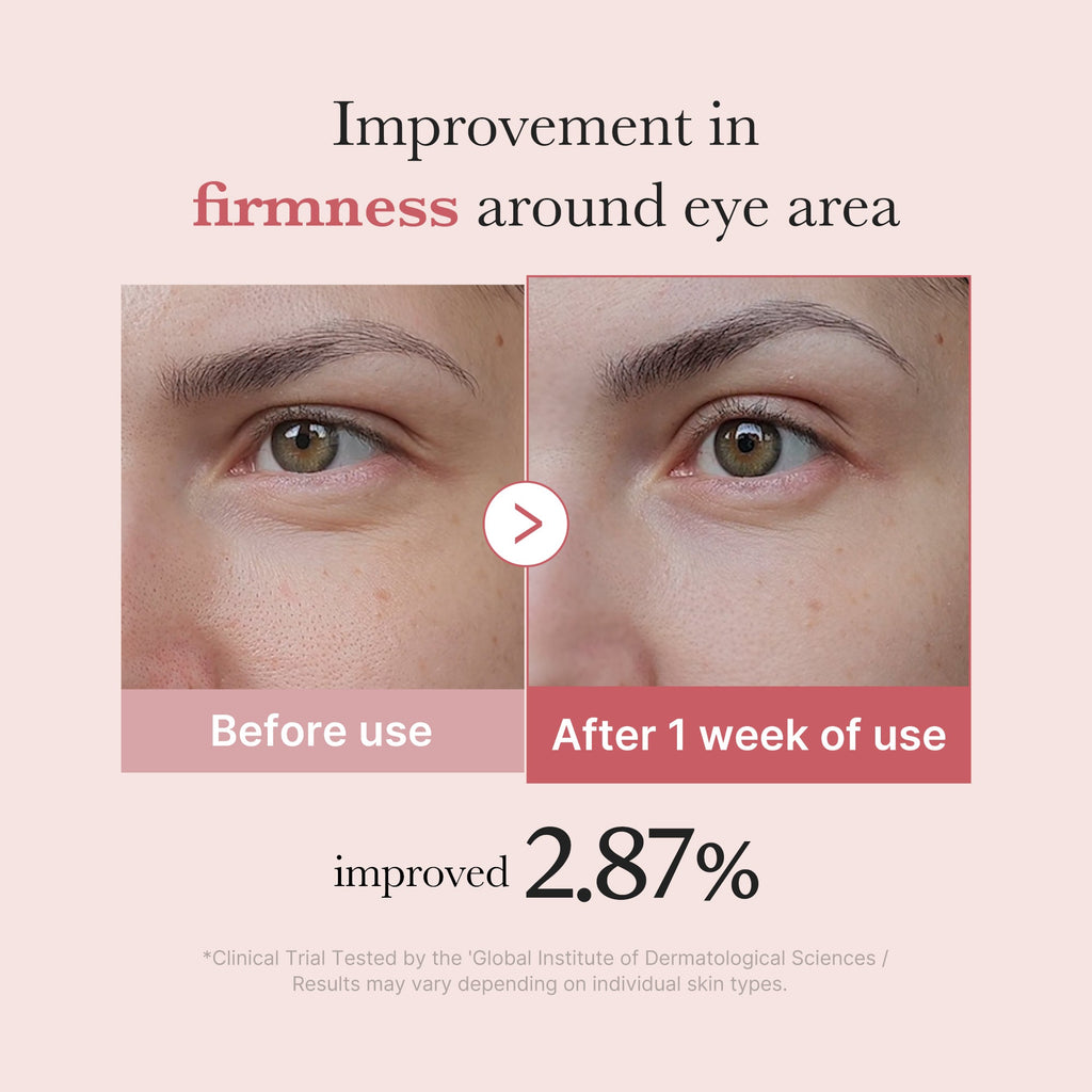 PDRN Pink Peptide Eye Cream C2