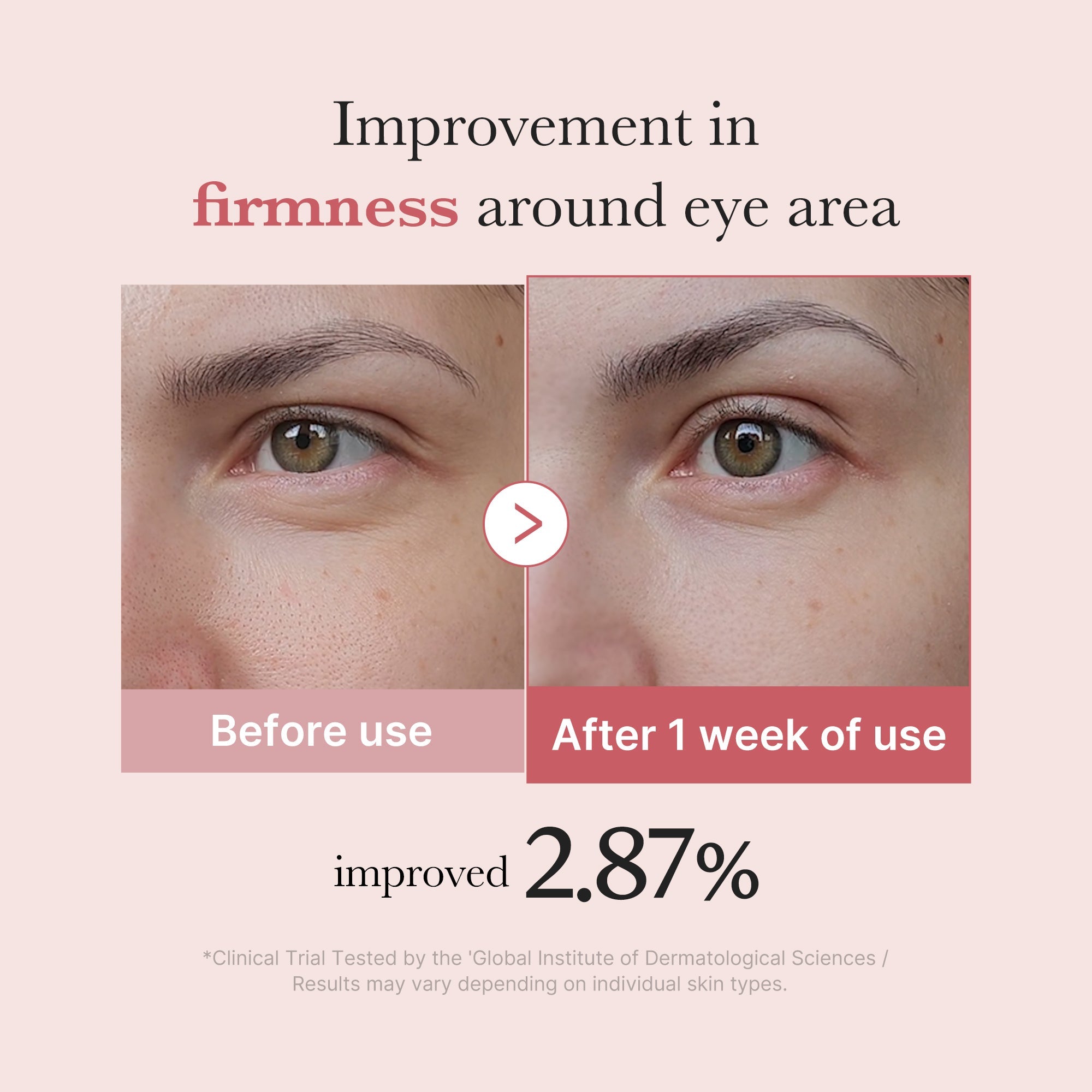 PDRN Pink Peptide Eye Cream C2