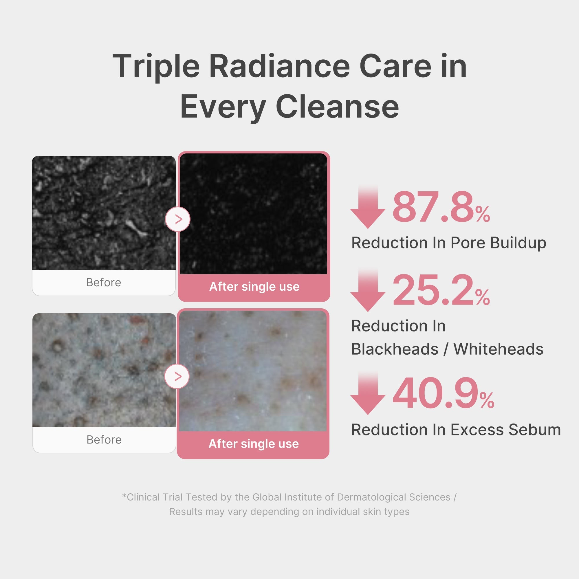 PDRN Pink Glutathione Capsule Foam Cleanser X3