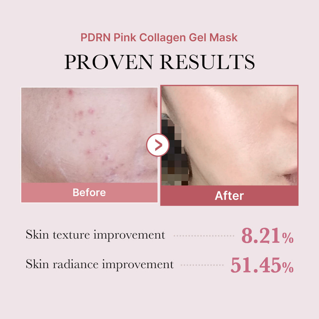 PDRN Pink Glow Full Set C2