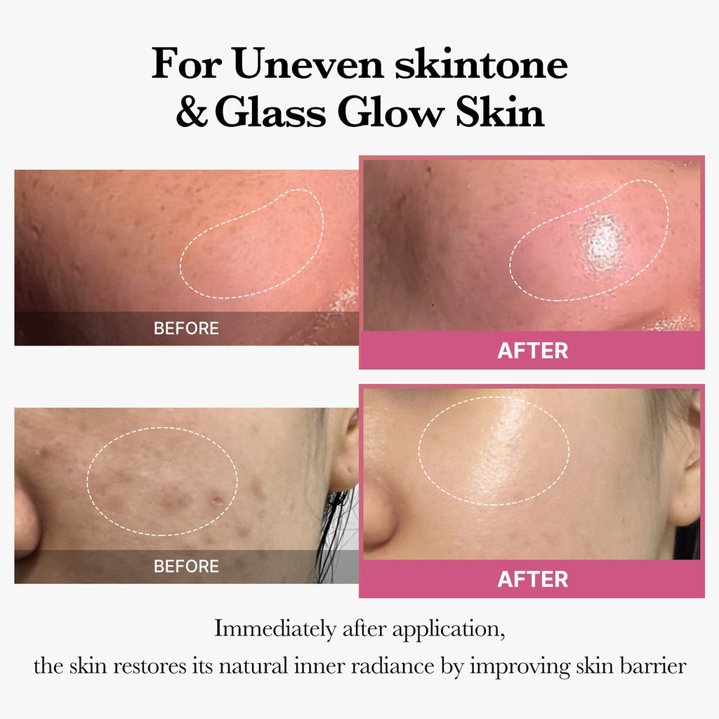[Tati's Exclusive] All About Glow Set U9